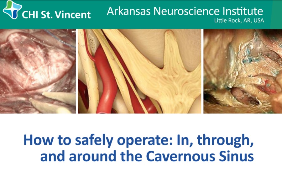 How to safely operate