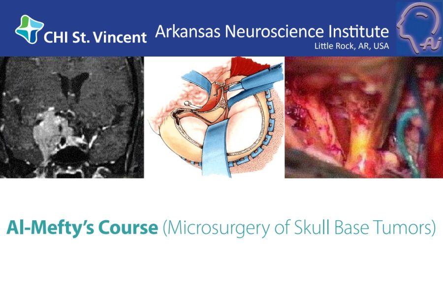 Microsurgery of Skull Base Tumors-